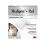 Mediopore Pad: Medicazione Adesiva 10x15cm - Pacco da 5 Pezzi