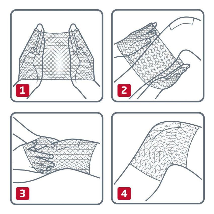 Benda Elastofix di Sostegno e Fissaggio per Ginocchio e Coscia, 250cm