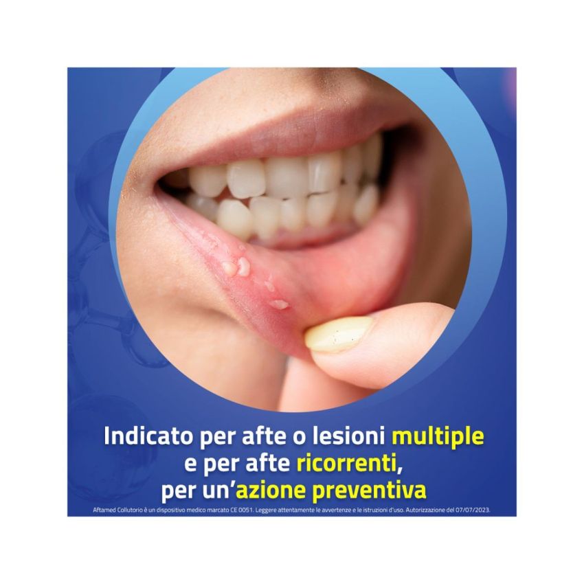 Aftamed Collutorio Risciacquo Bocca 150ml