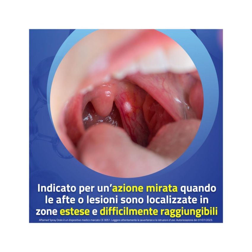 Aftamed Spray Orale 20ml per Ulcere e Afte