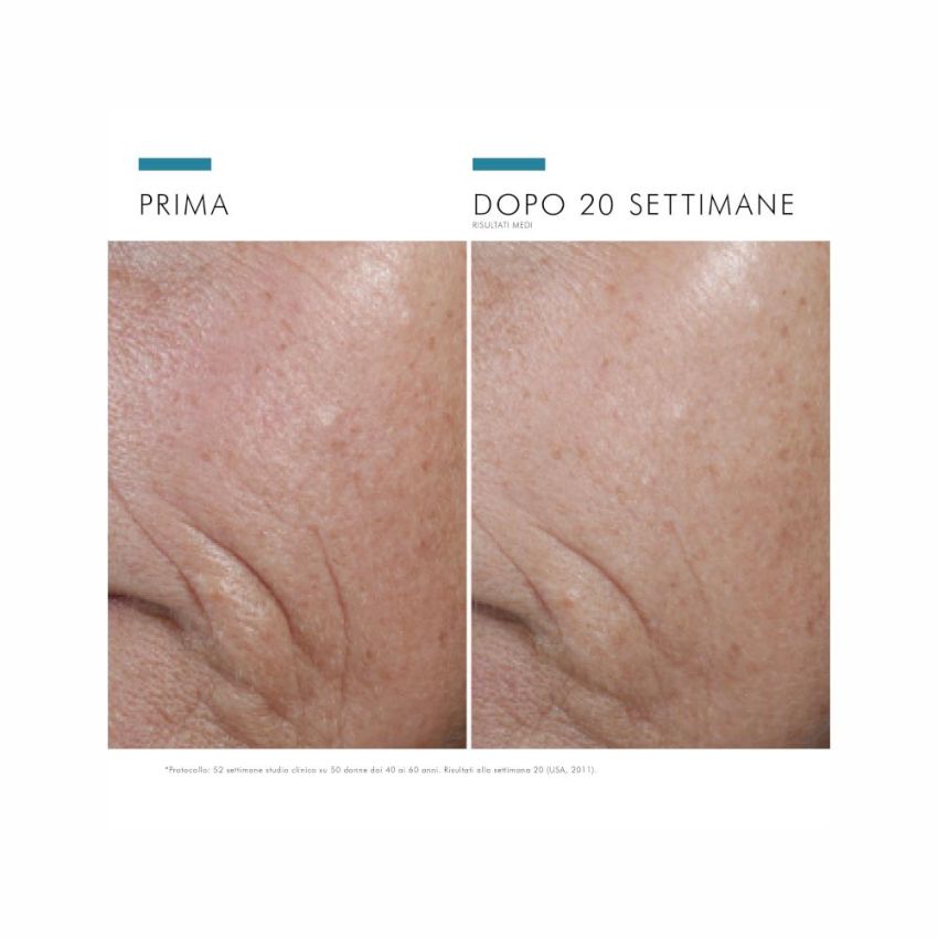 Trattamento Viso Antiossidante SkinCeuticals con Vitamina C e Ferulico 30ml