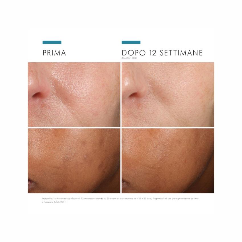 Siero Viso Antiossidante SkinCeuticals Phloretin CF con Vitamina C - 30 ml