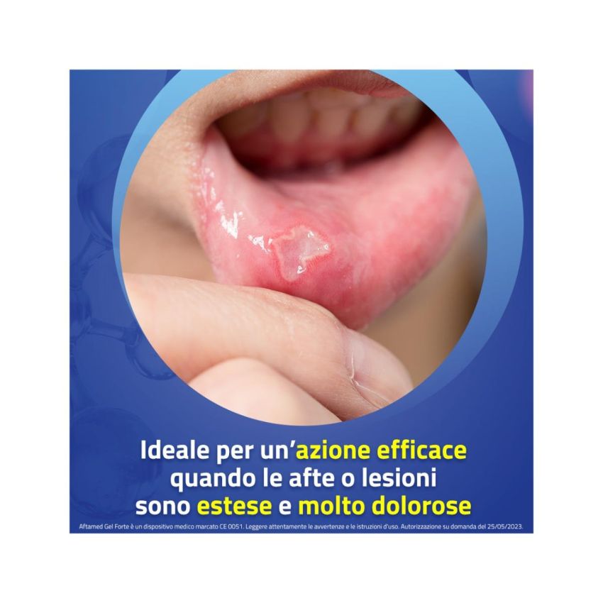 Aftamed Forte Gel Orale 8ml - Trattamento per Aphthe