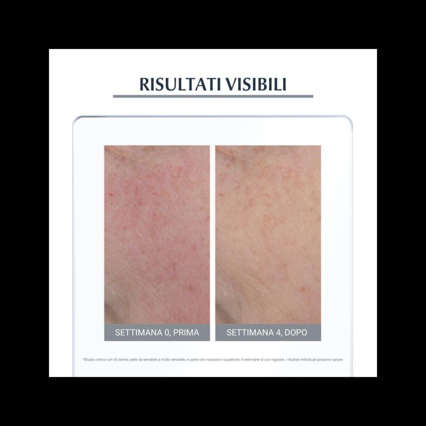 Eucerin Trattamento Giorno Anti-Rosacea con SPF 25 - 50ml