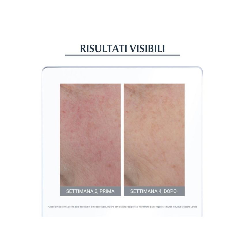 Eucerin Trattamento Notturno Lenitivo Antirose 50ml