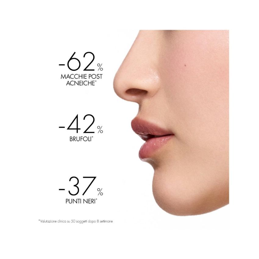 Vichy Normaderm Trattamento Giornaliero Anti-Imperfezioni 50ml