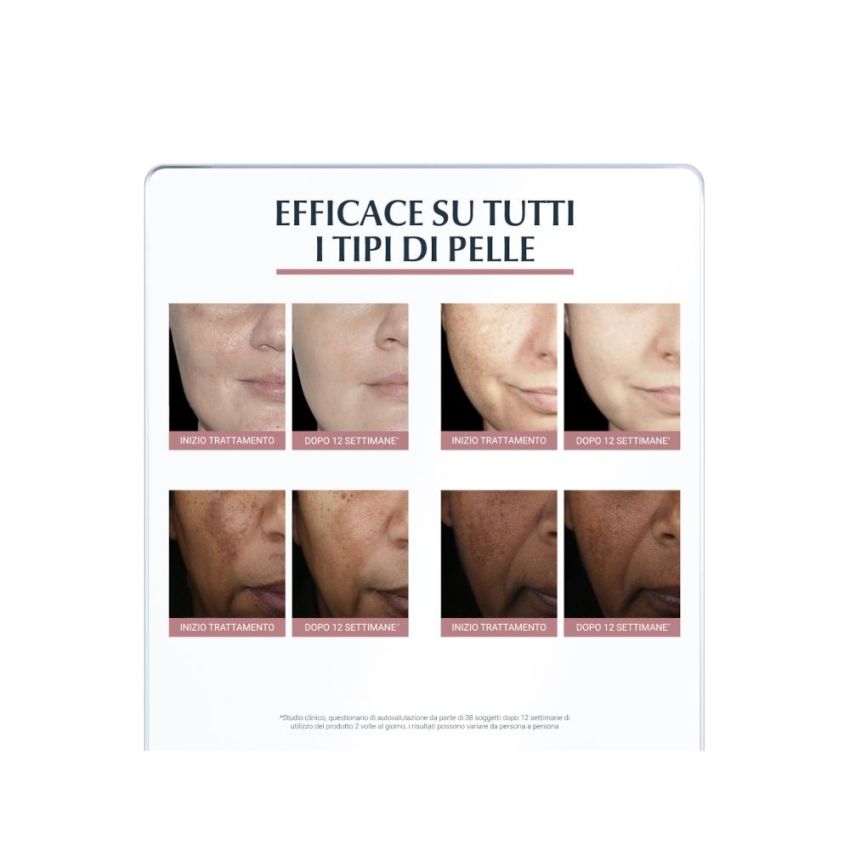 Eucerin Anti-Pigment Dual Action Serum, 30ml