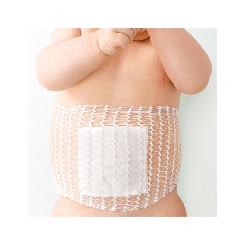 Benda di Fissaggio Elastofix per Ombelico da 2.5m