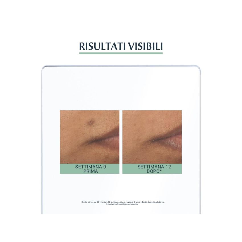 Siero Eucerin Dermopurifyer con Tripla Azione Controllo dell'Olio 40ml